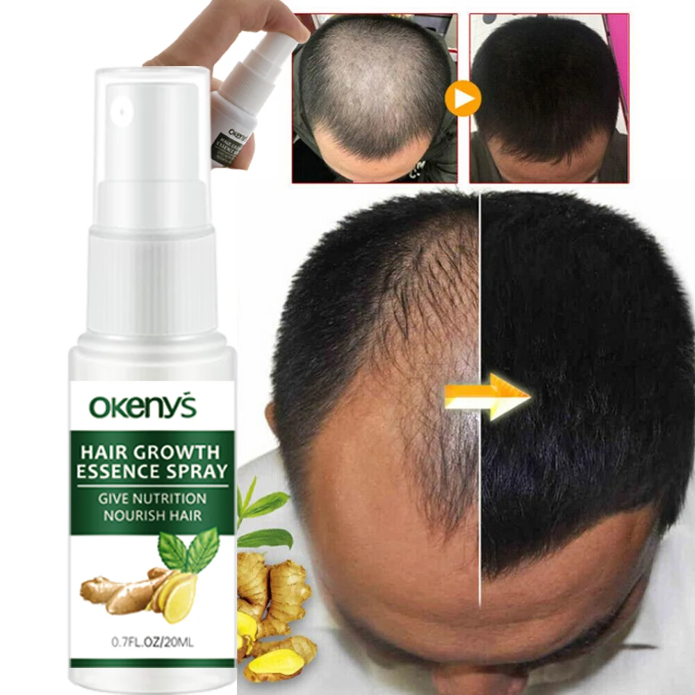 En venta Aceite de esencia de rápido crecimiento de pelo, suero nutritivo para el crecimiento del cabello de jengibre, tratamiento suavizante para la pérdida de cabello, reparación de cabello dañado, 7 días, 20ml KjwnegEzp3E