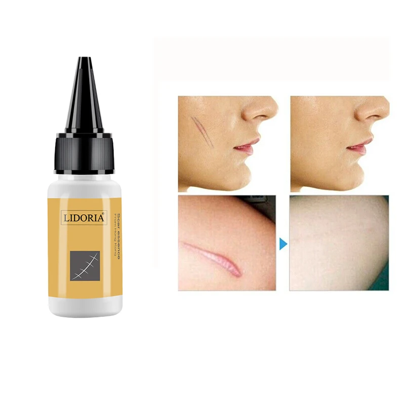 1pc 20ml Herbal Scar Mark Removal Skin Whole Body Care Cream Blemish Treatment Skin Scar Smoothing Repair Fluid Skincare TSLM1