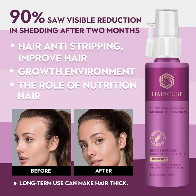 Hair Growth Treatment Spray Anti Hair Loss Essence Serum for Fast Thick