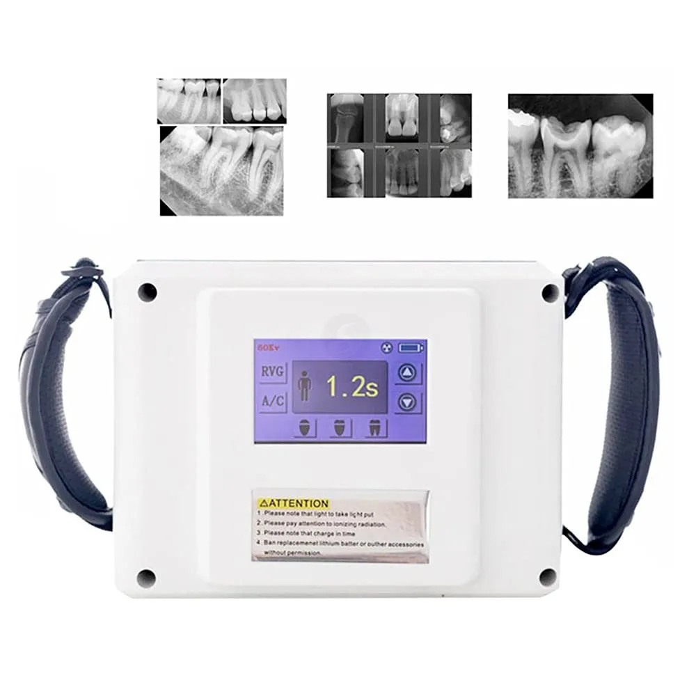 

Good Touch Screen Dental X Ray Camera Unit/High Frequency Dental x-ray machine portable /Dental Imaging System Supplier