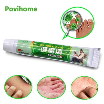 

1pcs 20g Eczema Psoriasis Ointment Skin Antibacterial Cream Pruritus Dermatitis Itching Chinese Herbal Medical Plaster P1058