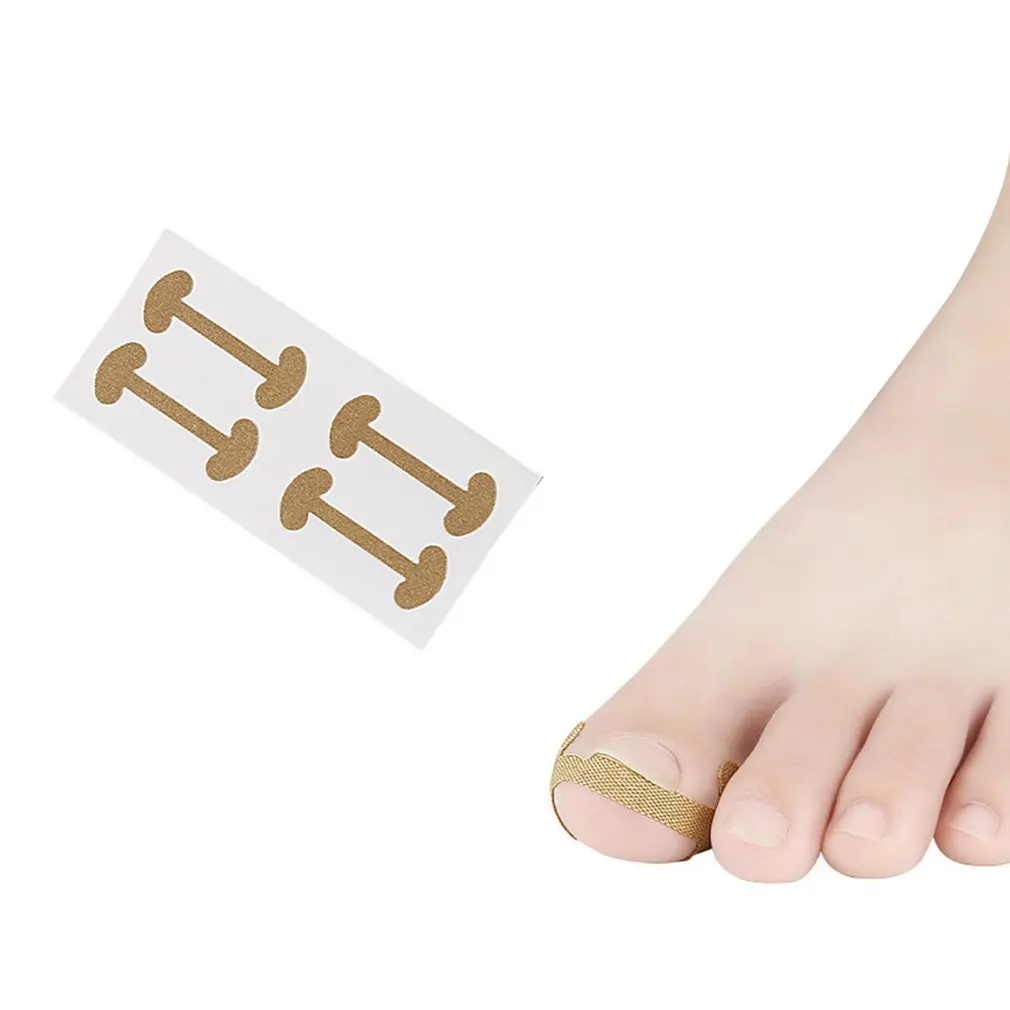 Ногти на ногах ногти паз Socketed Toenail Ортодонтическое приспособление большого пальца рулон дизайн ногтей для быстрого ремонта тоэнил деформированный мешок для мяса