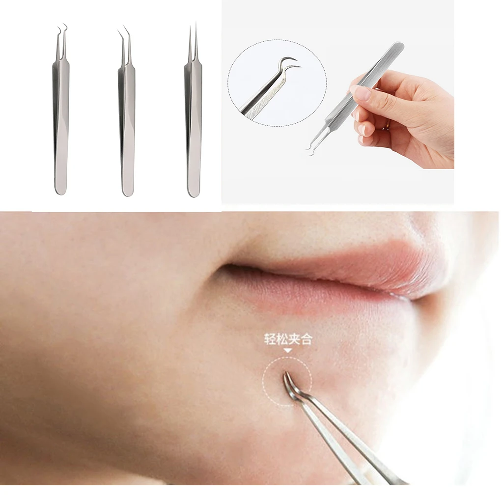 Pinzas de acero inoxidable con gancho para acné y puntos negros, Kit de removedor de comedones, limpiador facial, novedad de 2020