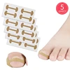 20Pcs G115