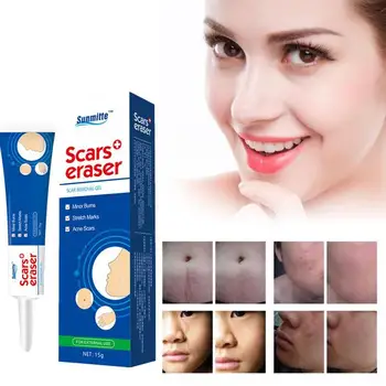 

Scar Removal Cream Acne Scars Gel Stretch Marks Surgical Scar Burn For Body Pigmentation Corrector Acne Spots Repair Care 15g