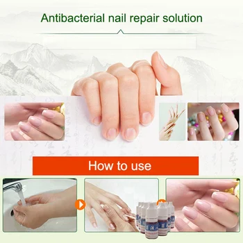 

Newly 2pcs 10ml Health Skin Care Nail Repair Liquid Cleanser Onychomycosis Remover Beauty Disinfect Water CLA88