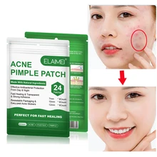 Стикер для удаления акне, против акне, против угрей, лечение угрей, маска для ухода за кожей, средство для ухода за лицом, лечение 24 патчи