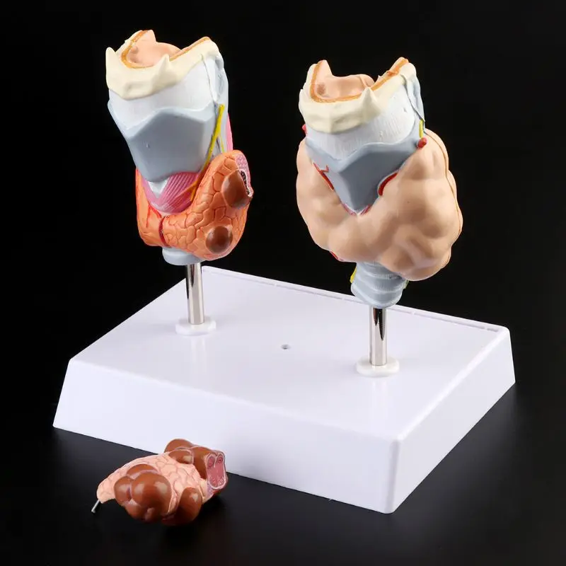 Human Thyroid Anatomical Pathology Model Normal and Disease Pathologies Medical Teaching Resource Tool