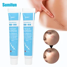 20g Acne Scar Removal Cream Treatment Acne Stretch Marks Pimples Spots Repair Gel Body Pigmentation Acne Spots Repair Care