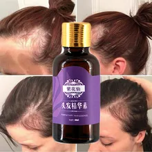 Уход за волосами эссенция Предотвращение выпадения волос эффективный рост питает масло контроль Jinhuameixiu волосы жидкость против поворота роста