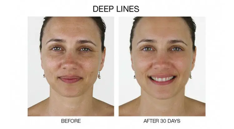 matrixyl niacinamide