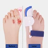 2Pcs Hallux Valgus Corrector For Feet Toe Separator Fingers Feet Haluksy Separator For Toe Orthopedic Foot Care Bunion Corrector ► Photo 3/6