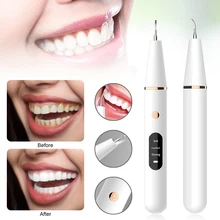 

Multifunction Electric Tooth Polisher Oral Water Flosser Stain Plaque Remover Teeth Whitening Cleaning Tool Tooth Dirt Cleaner