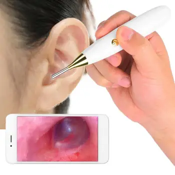 

Iphone Android Telefon WIFI Visuelle Otoskop Medizinische Ohr Inspektion Kamera 1MP Endoskop Kamera Ear Inspection Camera