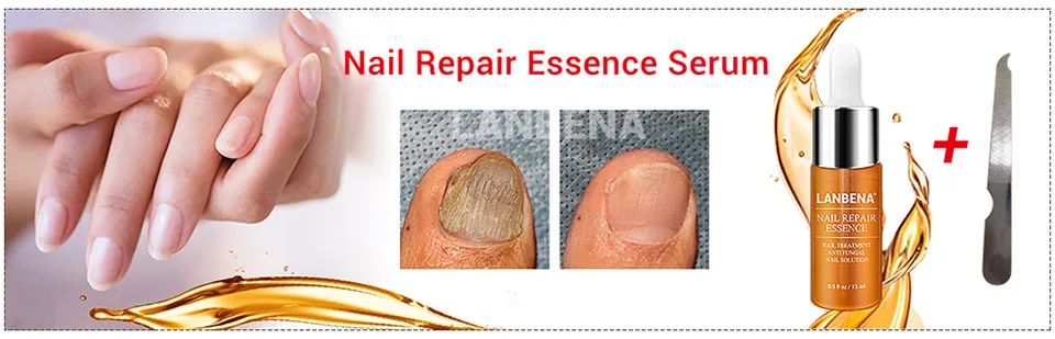 LANBENA эссенция для восстановления ногтей и гель эффективное лечение проблем с ногтями и ногтями на ногах