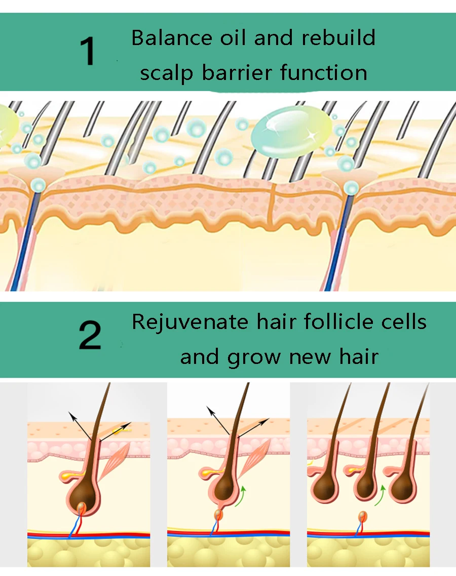 Уход За Волосами Эфирные масла для роста волос эссенция для роста волос жидкость для предотвращения выпадения волос забота о здоровье Красота Сыворотка для роста густых волос
