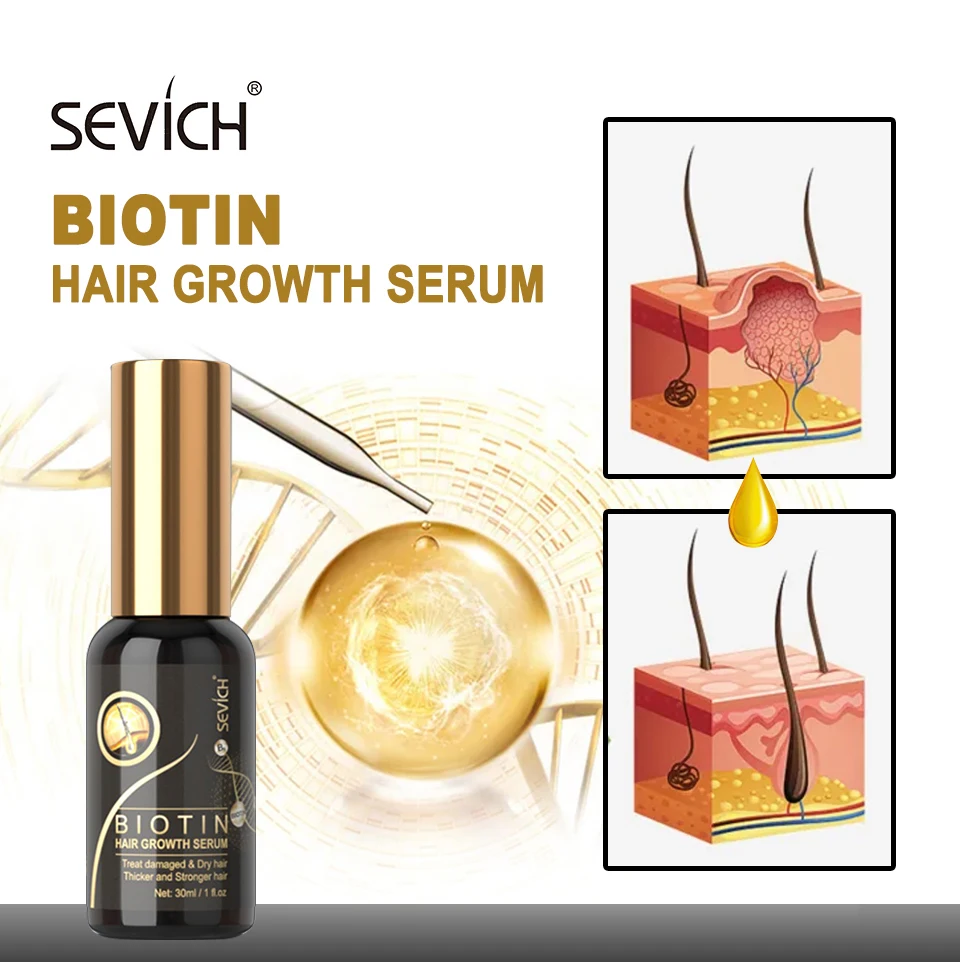 Sevich 30ミリリットルビオチン育毛スプレーハーブヘアケア血清高速抗脱毛治療不可欠育毛オイル 脱毛製品 Aliexpress