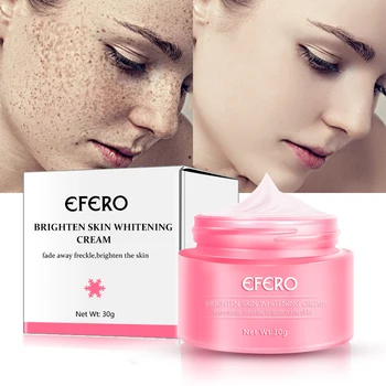 

EFERO Whitening Face Cream Freckle Cream Remove Melasma Acne Spots Pigment Melanin Dark Spots Brighten Skin Moisturizing Cream