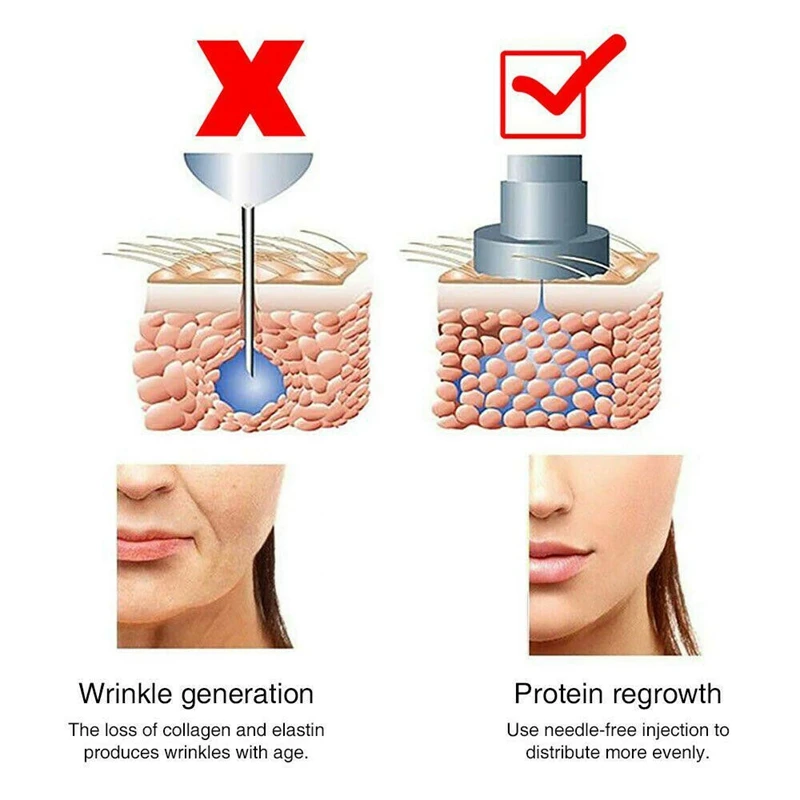  2 in 1 two head 0.3ml 0.5mlHyaluron Acid Pen Hyaluronic Acid lip filler Needle free Atomizer Anti W