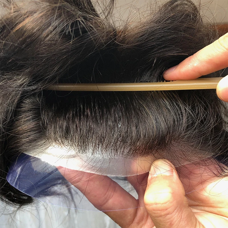 natural hairline