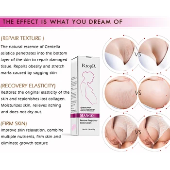 

Enhance Elasticity Skin Care Maternity Repair Slack Acne Anti Winkle Pregnancy Abdomen Treatment Stretch Mark Cream Remove Scar