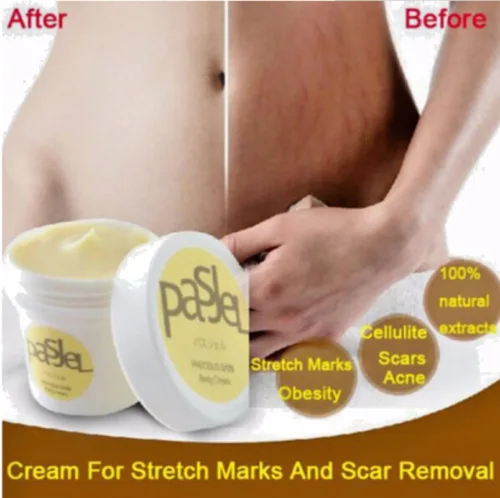 Genuine Thailand Skin Body Cream Remove Stretch Marks Treatment Postpartum Repair Whitening CREAM Pregnancy Scar Removal 50g |
