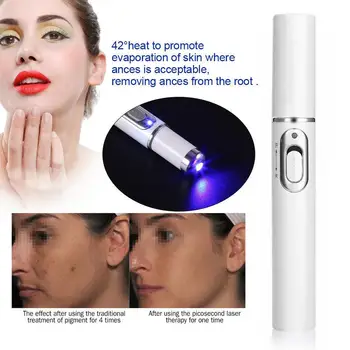 

Eye Massager Instrument for Eye Bags Dark Circles Wrinkles Eye Meter Acne Pen Scar Wrinkle Blemish Removal for women Beauty Care
