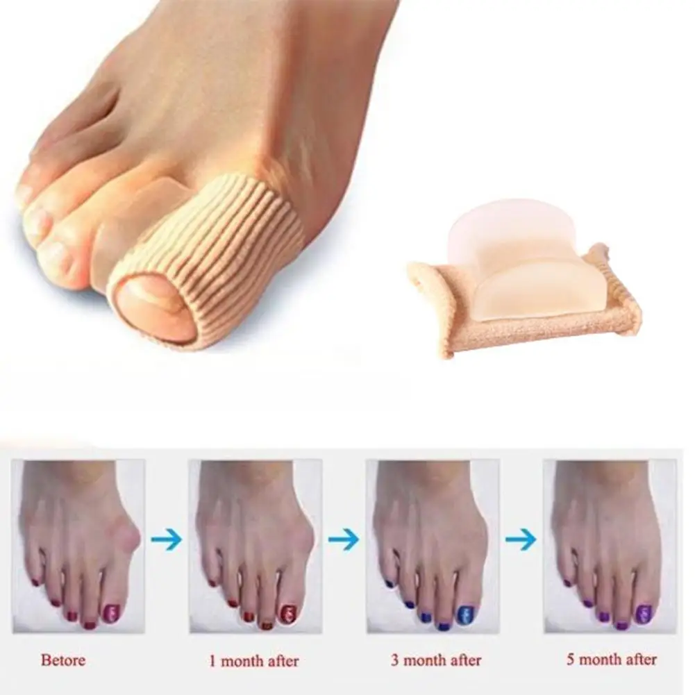 Toe Separator Hallux Valgus Bunion Corrector Orthotics Feet Bone Thumb Adjuster Correction Pedicure Sock Straightener