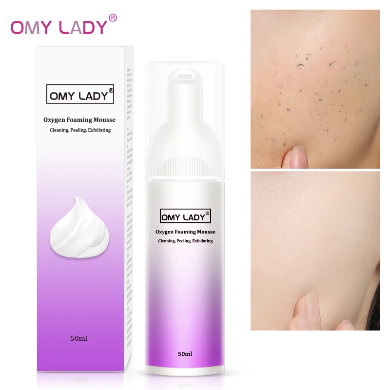 

OMY LADY Oxygen Foaming Mousse Deep Cleansing Face Cleanser Aloe Vera Moisturizing Oil Control Shrink Pores Remove Blackhead