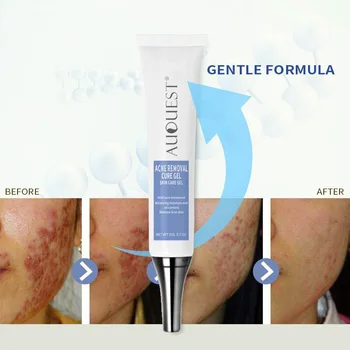 

Acne Cream Moisturizing Oil Control Shrink Pores Acne Scar Removal Cream Repair Cream EY669