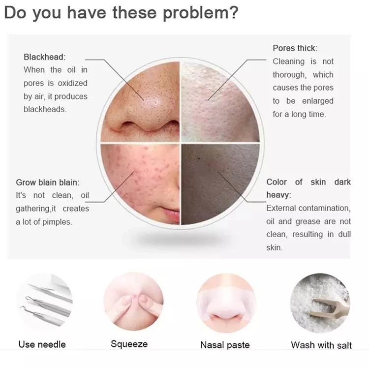 Black Dots Vacuum Pore Cleaner Nose Black Point Remover Blackhead Acne Pimple Removal Suction Extractor Facial Beauty Tools SPA