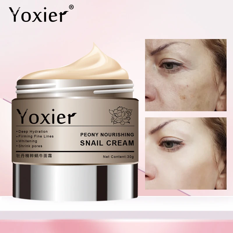Yoxier 3 шт./лот питательный крем с пионами и улиткой антивозрастной для лица