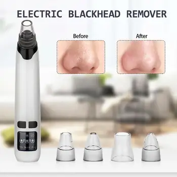 

Electric Blackhead Vacuum Remover Nose Pore Cleaner Acne Pimple Removal Vacuum Suction Facial Diamond Dermabrasion Machine
