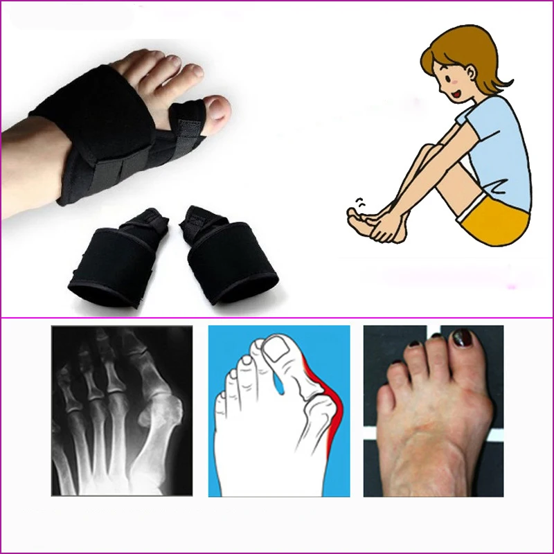 Foot Care Massager Toe Bunion Splint Straightener Corrector Foot Hallux Valgus Correction Pedicure Tool Orthopedic Toe Separator