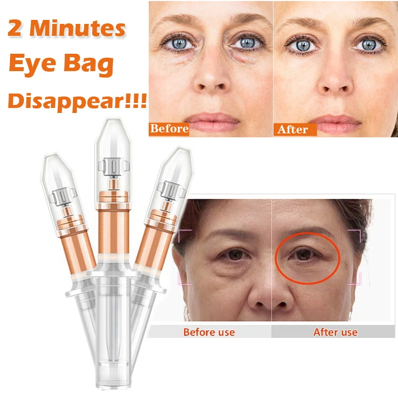 2 Minutes Instantly Eye Bag Removal Cream Effect Puffiness Wrinkles Fine Lines Eye Bags Dark Circles Remove Eye Cream Creams Aliexpress