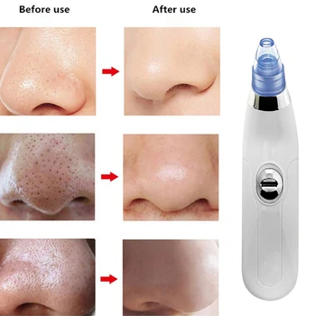 

Pore Cleaner Blackhead Remover Vacuum Electric Nose Face Deep Cleansing Come do Suction Facial Beauty Machine Skin Care Machine