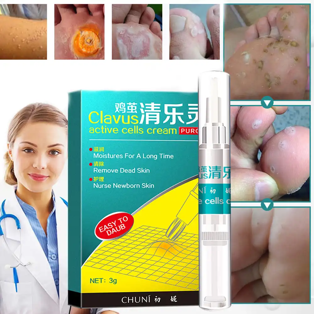 3g mole & skin tag repair solution painless mole