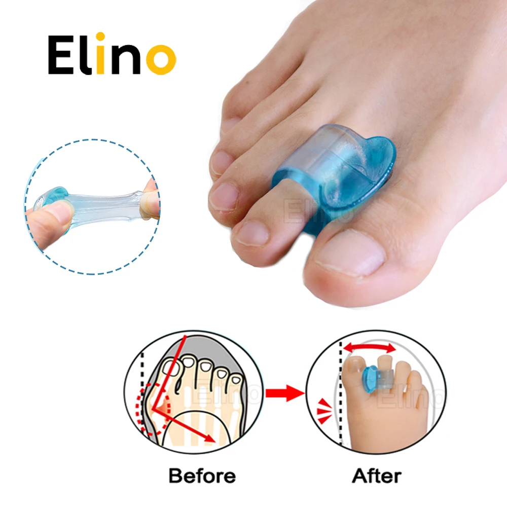 

Toes Separator for Soft Silicone Gel Hallux Valgus Corrector Bunion Bone Ectropion Adjuster Toe Outer Appliance Foot Care Tools