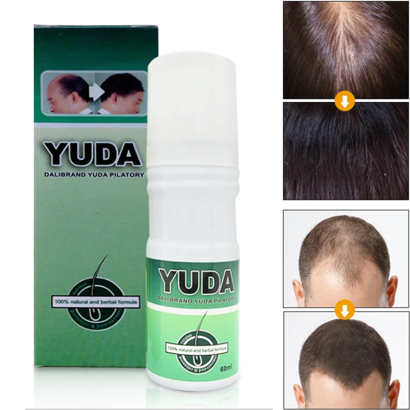 3pcs Original YUDA sterile liquid hair prevent package scalp hair care hair growth fluid Anti-hair loss Products
