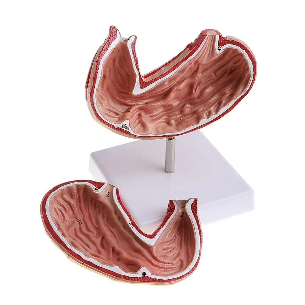 Съемная анатомическая модель с человеческим желудком 2 части 1:1 Lifesize|ulcer| |