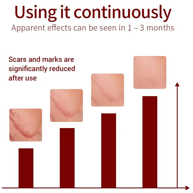 LANBENA крем для удаления шрамов лечение акне ремонт шрамов не раздражающий отбеливающий крем против морщин, увлажняющий уход за кожей 40 г