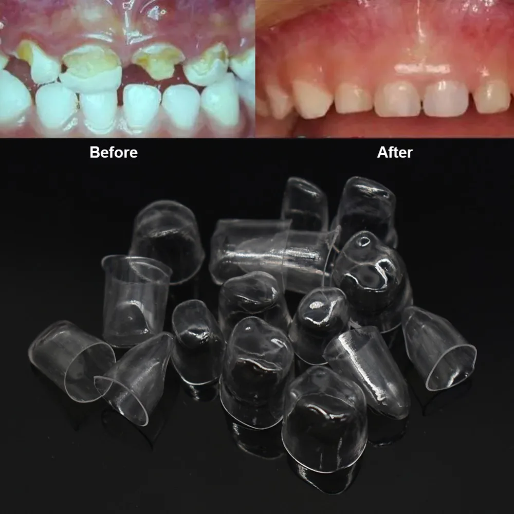 64 шт. стоматологические Передние Прозрачные короны Лиственные зубы для взрослых и детей стоматологические инструменты для отбеливания зубов