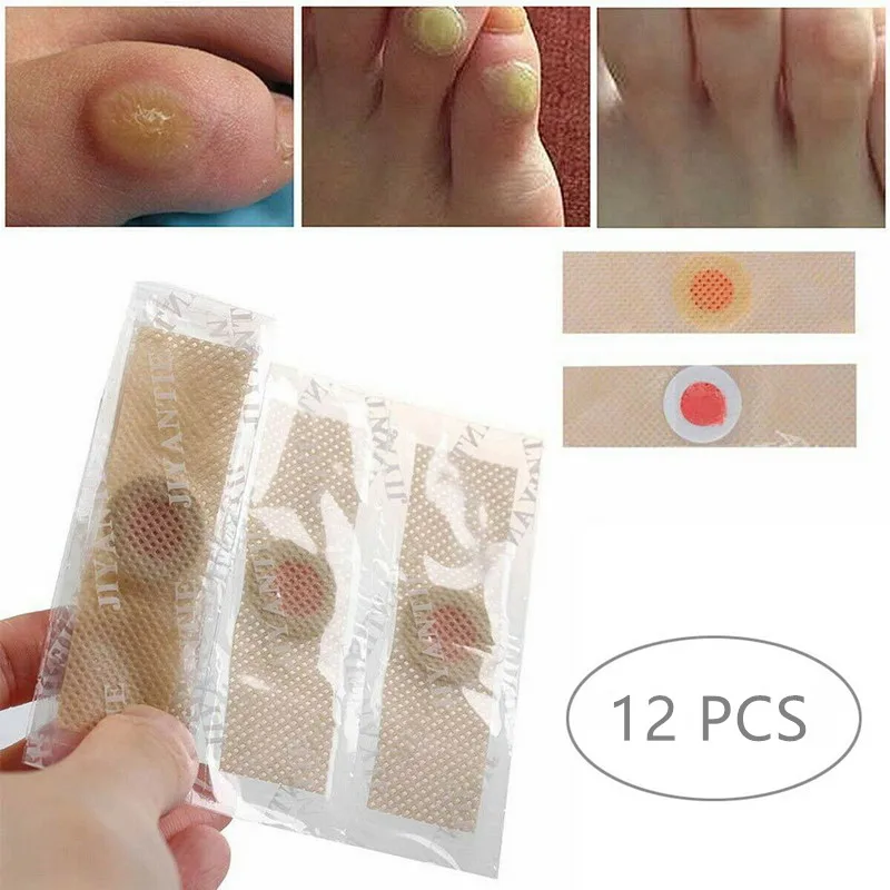 Hot Sale Pads Wart-Remover Warts Foot-Corn-Removal Patch-Health-Care Medical Plaster Pain-Relief R6qpjYWJO