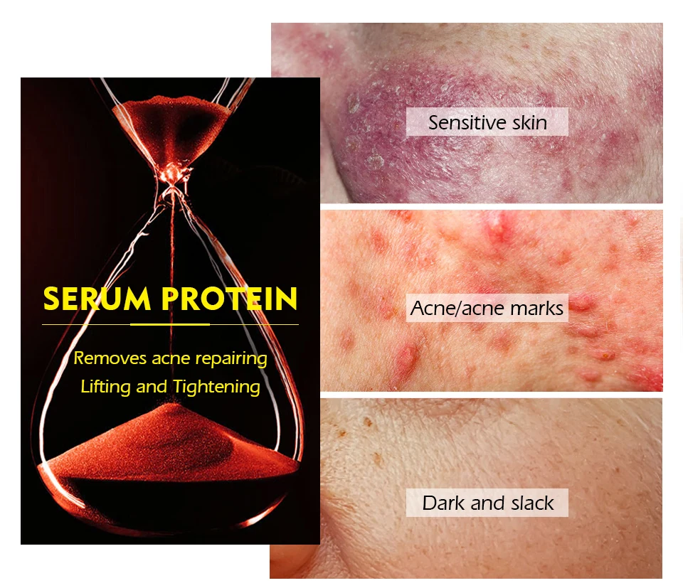 血清蛋白无水面膜_03(1)