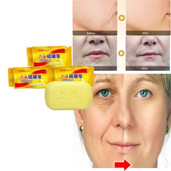 

100% sulfur soap to dispel blackhead and relieve itching bath soap for acne treatment of fungal dermatitis and skin protection