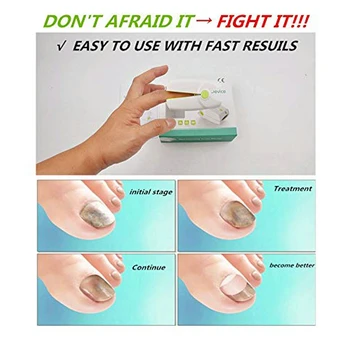 

Low Level Laser Therapy Device For Nail Laser Toe Nail Fungus Treatment Device Finger Nails Health Care Onychomycosis Laser CE