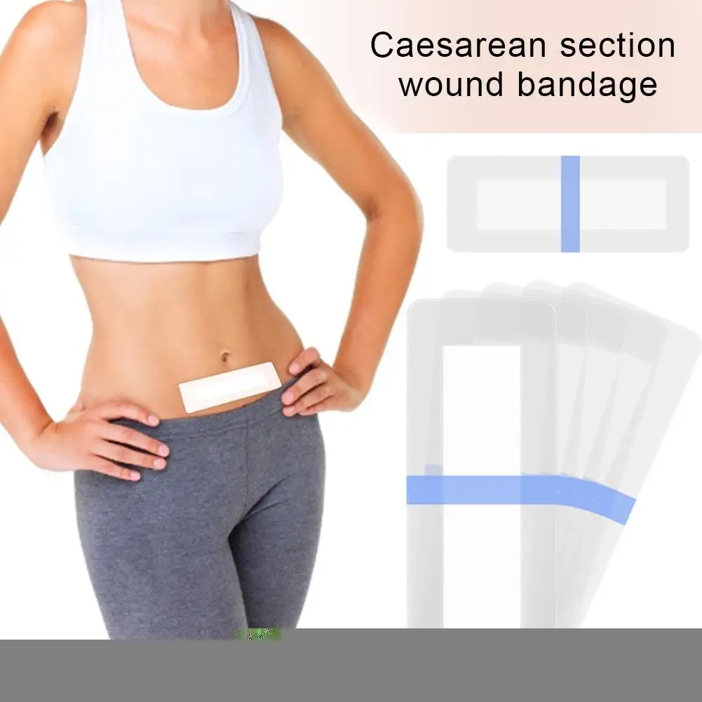 5pcs Efficient Caesarean Section Surgery Removal Scar Sheet Therapy Patch For Acne Trauma Burn Scar Skin Repair Beauty Stickers
