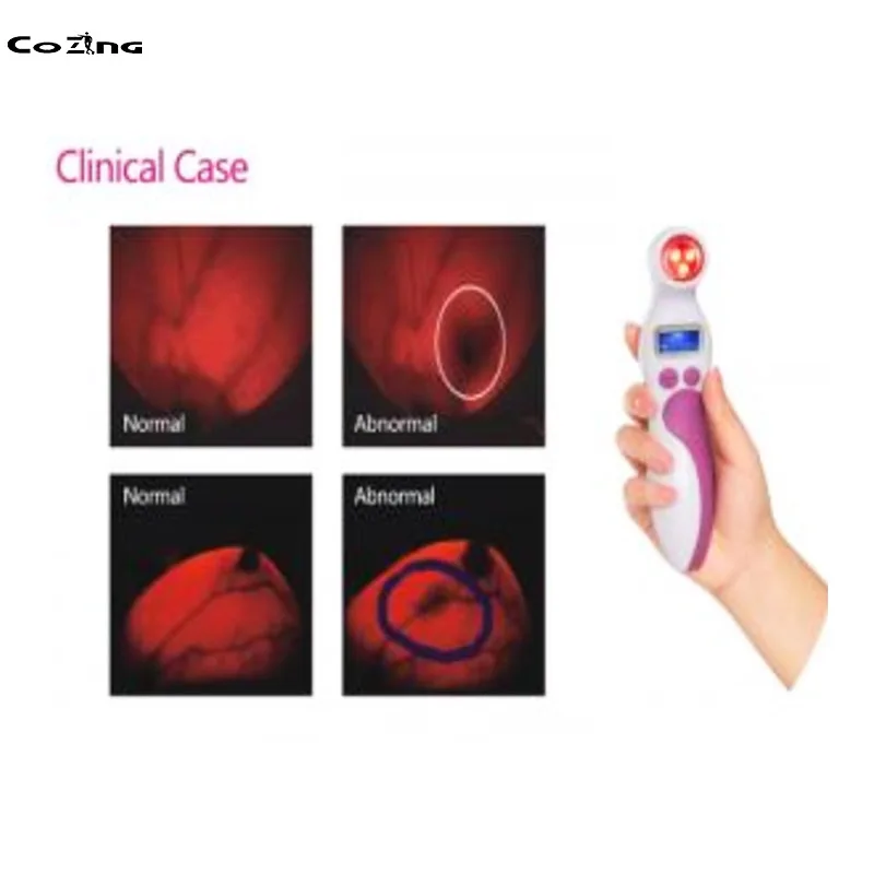 Red Light Therapy 650nm Breast Hyperplasia, Acute Mastitis Check Device With Red Led Light For Women Health a vein imaging flashlight vascular display flashlight hand puncture to check blood vessels light