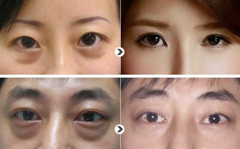 5b06b67171aaf720c914fab1-4-original