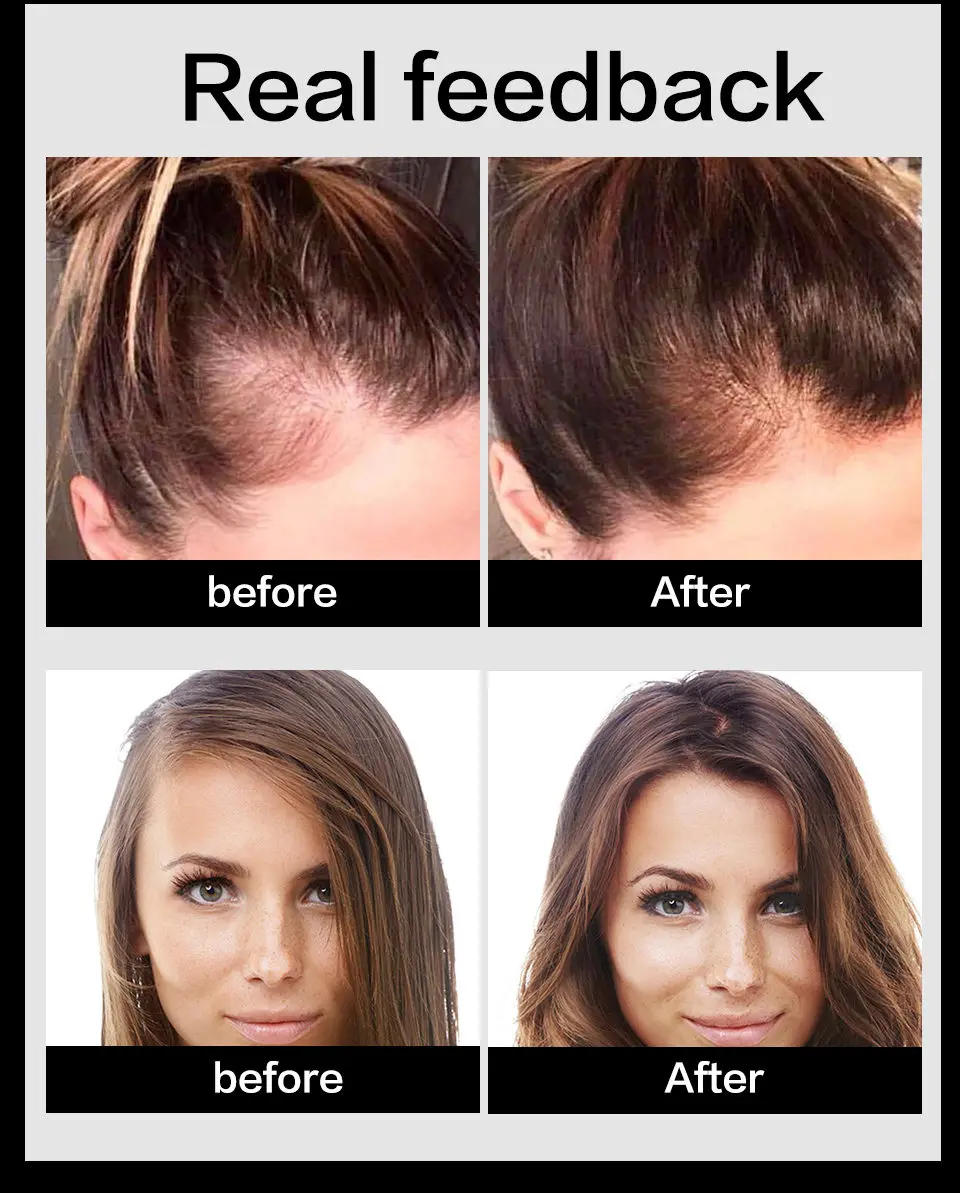 Эссенция роста волос масло для роста волос лечение мужчин t продукты против выпадения волос уход за волосами тонизирующие решения для волос для женщин мужчин выпадение волос